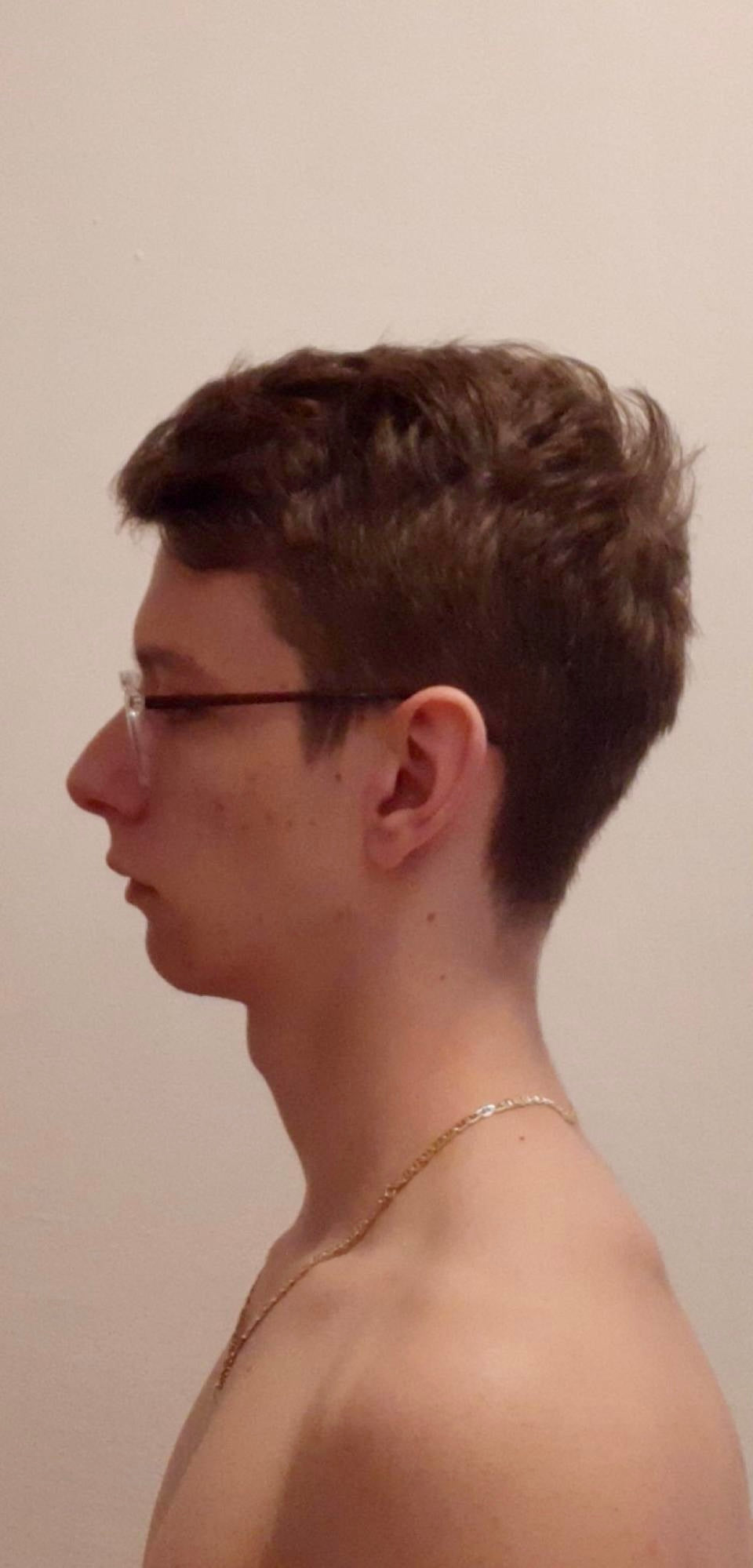Before image